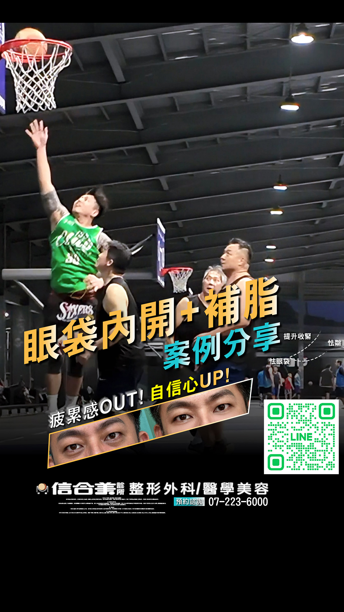 眼袋案例